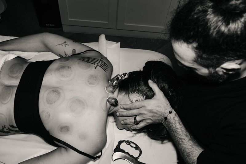Nad Marwani using cupping and neck release for desk-related back pain in Bangkok
